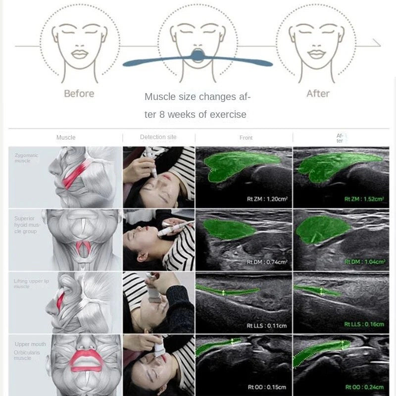 Jaw Exerciser Face-lift V Face Thin Face Artifact Nasolabial Wrinkle Remover Double Chin Reducer Face Lift Neck Muscle Trainer