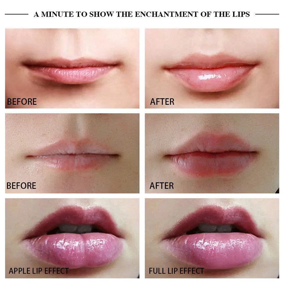 Silicone Lip Plumper Device Care Tool Sexy Bigger Lips Enlarger Labios Aumento Pump Natural Waterproof Anti Power Battery Skin