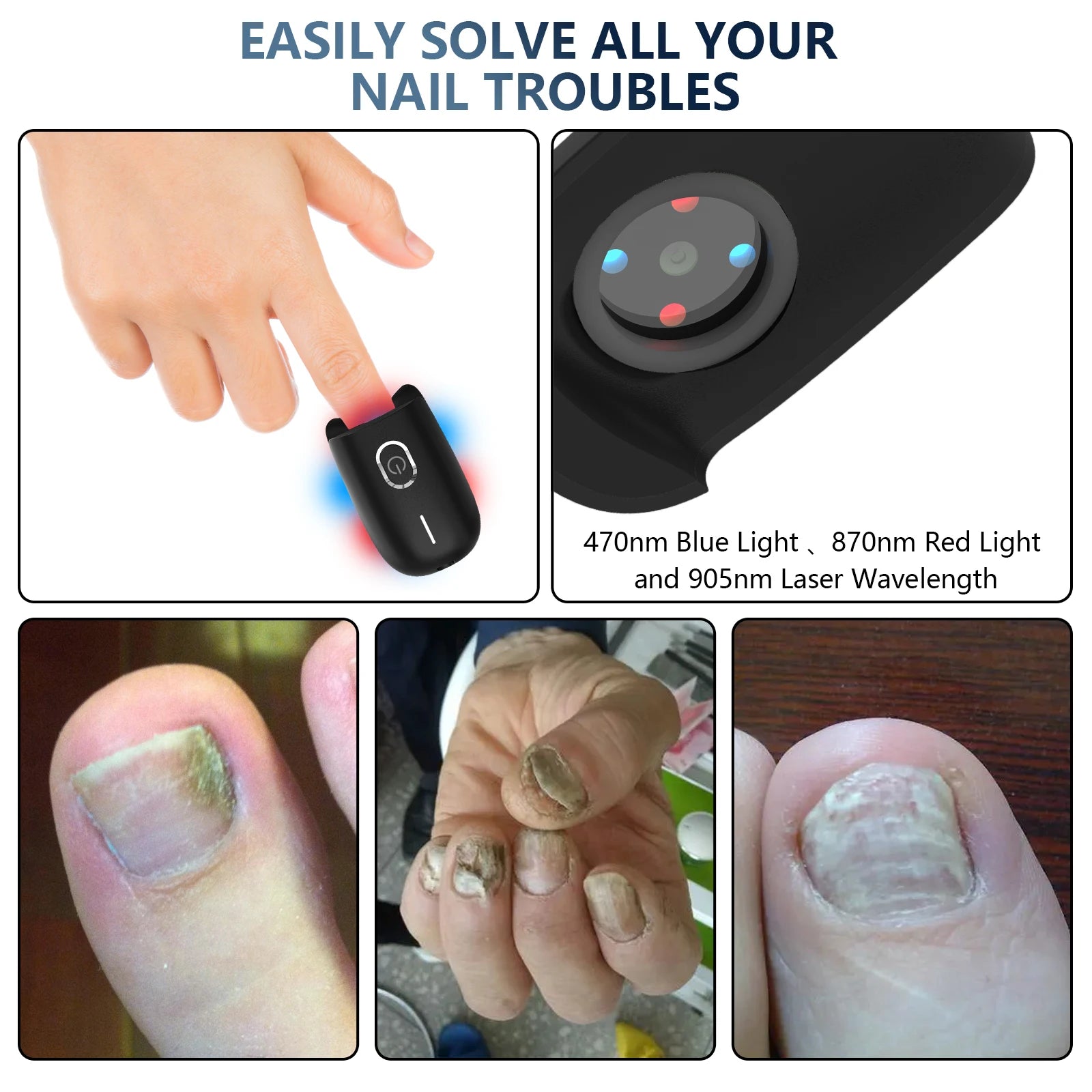 Fungal Nail Laser Device Repair Fast Nails Fungus Onychomycosis