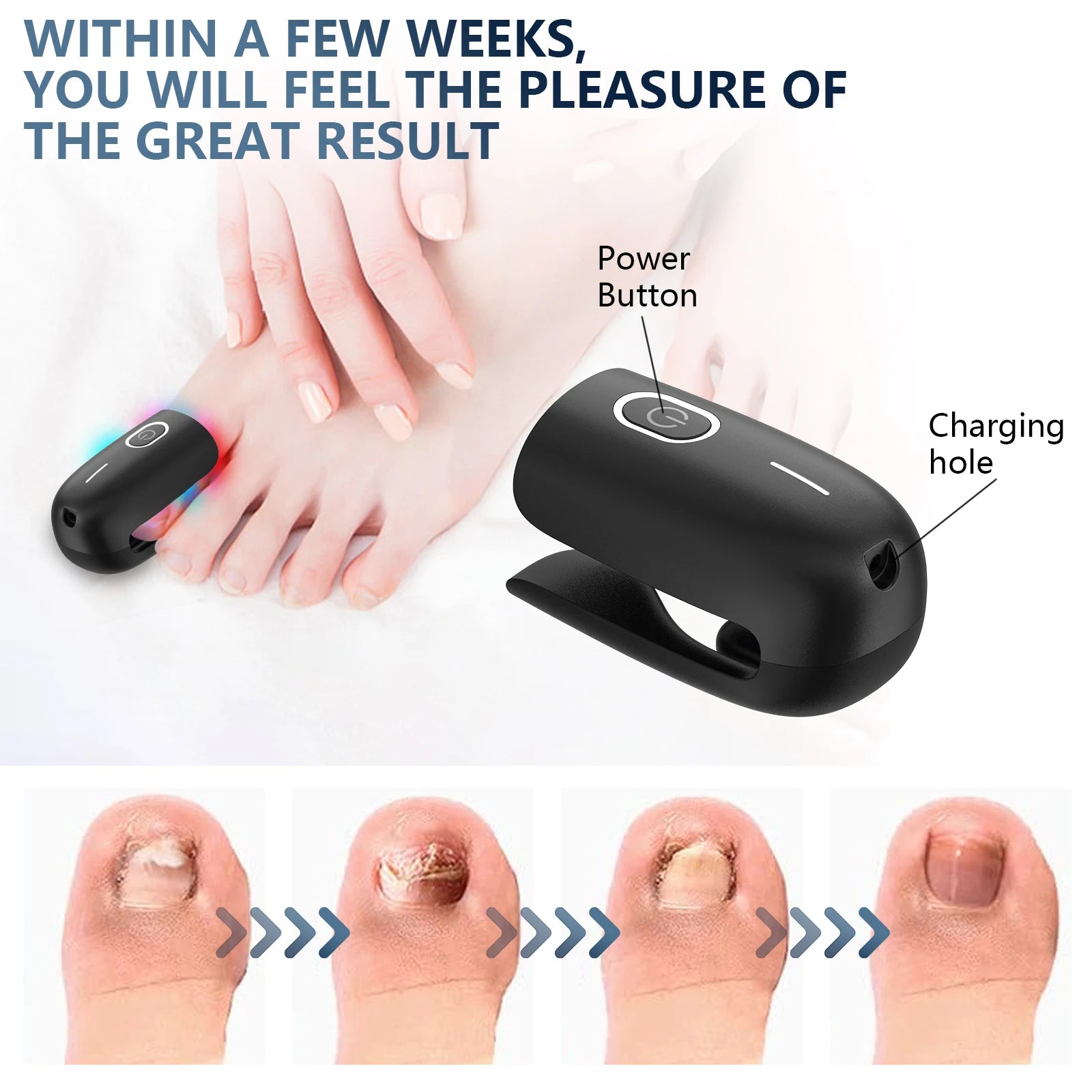 Fungal Nail Laser Device Repair Fast Nails Fungus Onychomycosis